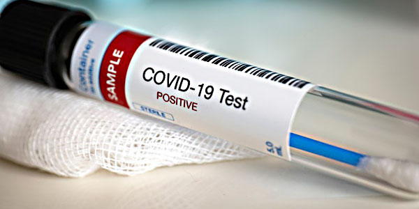 Covid-19 positive