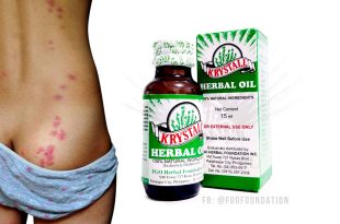 Krystall Herbal Oil, Insect Bites