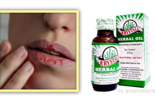 Krystall Herbal Oil dried lips Nagbitak na labi