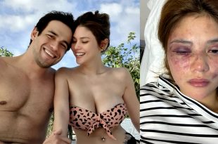 Kit Thompson Ana Jalandoni