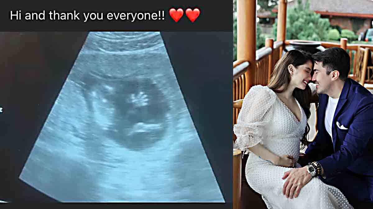 Jessy Mendiola Luis Manzano baby