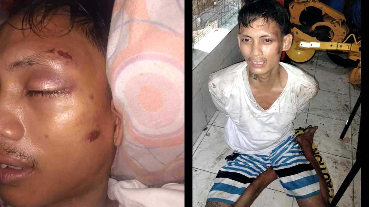 ‘Mangangalakal’ bugbog-sarado sa 15 sekyu ng Las Piñas subdivision
