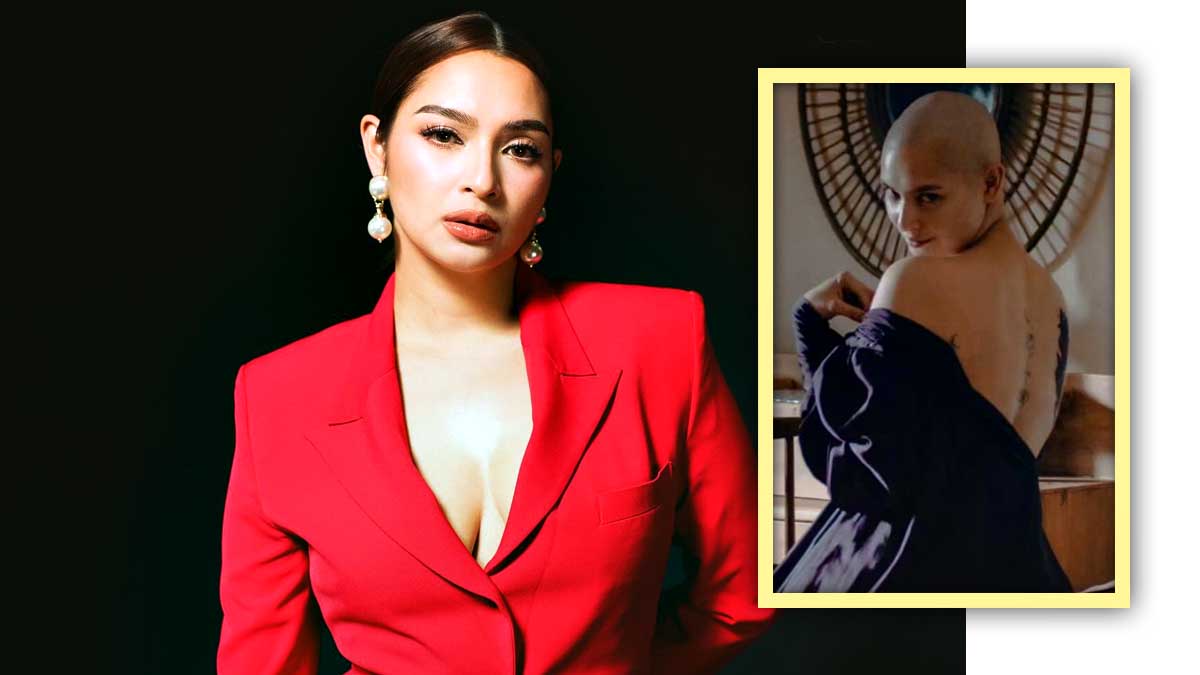 Ryza Cenon Bald Kalbo