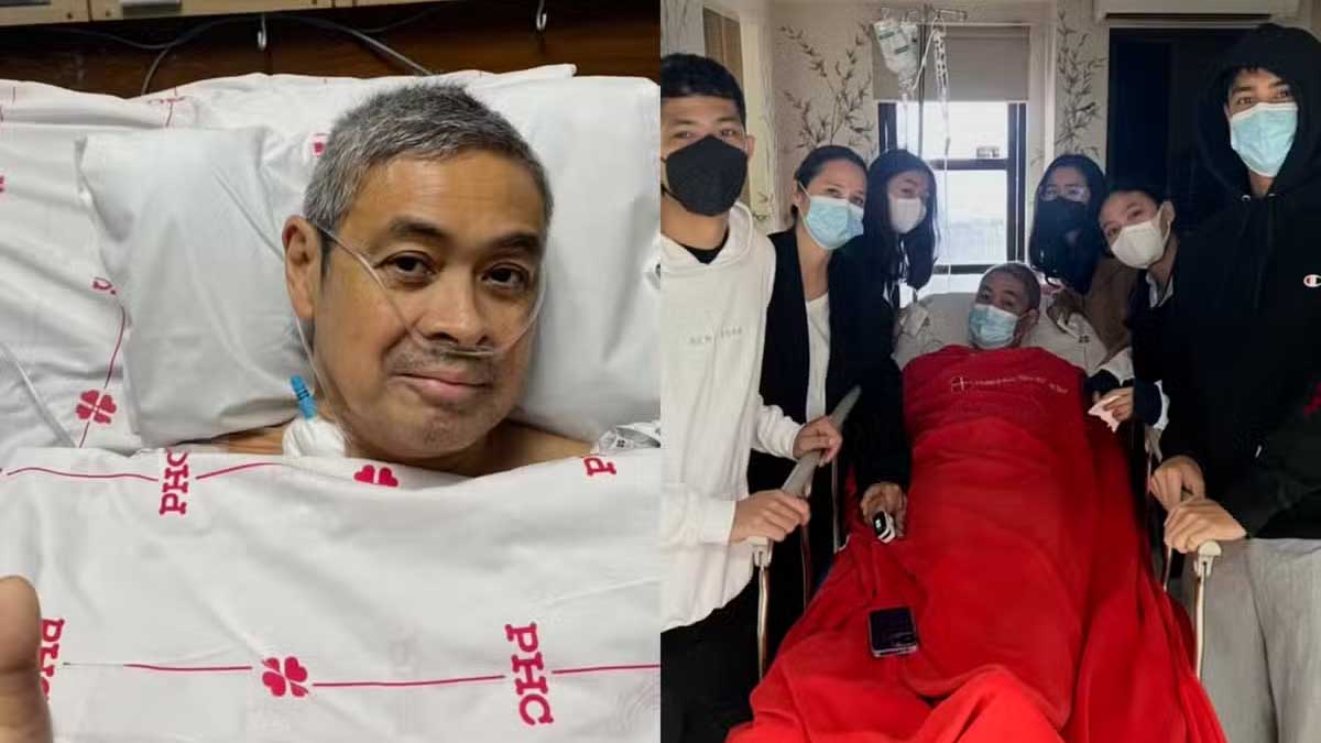 Anthony Pangilinan Surgey