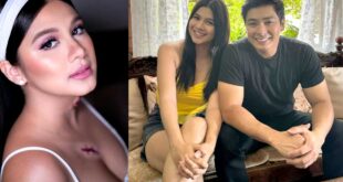 Kim Rodriguez ‘di malilimutan pag-aalaga  ni Coco