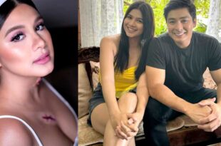 Coco Martin Kim Rodriguez