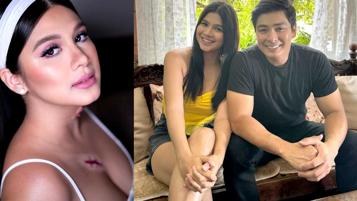Coco Martin Kim Rodriguez