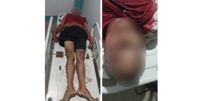 Sinugod ng mga nag-iinuman Lalaki sa Laguna patay sa saksak
