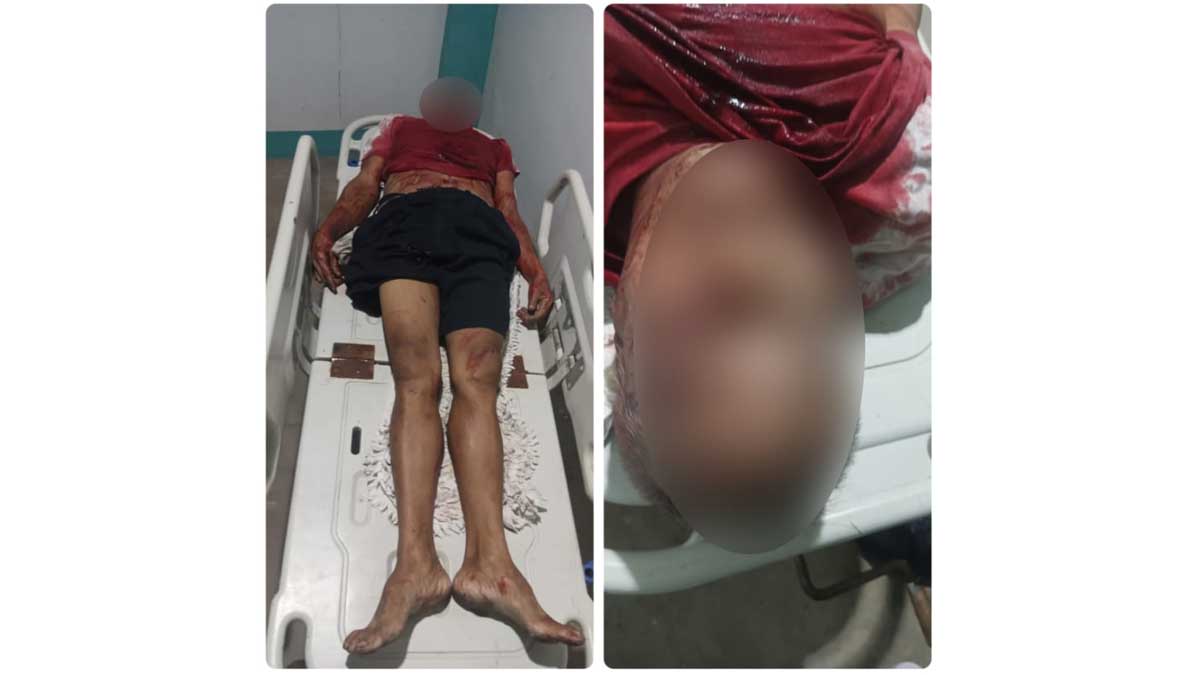 Sinugod ng mga nag-iinuman Lalaki sa Laguna patay sa saksak