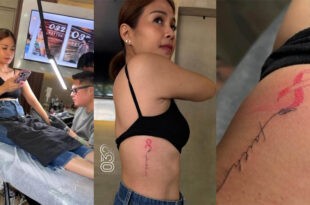 Kaye Abad Cancer Survivors Month