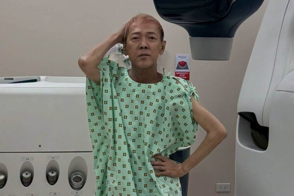 Ate Gay nakitaan ng bukol sa ibaba ng leeg